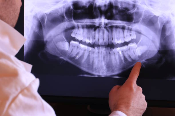Best Broken or Cracked Tooth Emergency Dentist in Loxley, AL